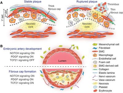 Mechanisms of fibrous cap formation in atherosclerosis